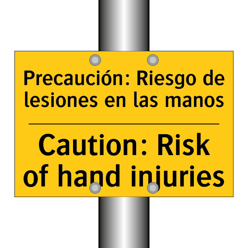 Precaución: Riesgo de lesiones en las manos - Caution: Risk of hand injuries
