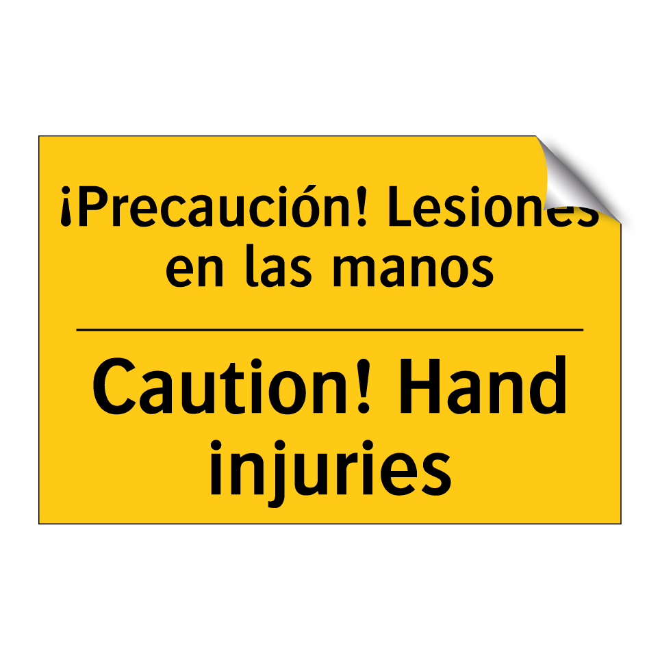 ¡Precaución! Lesiones en las manos - Caution! Hand injuries
